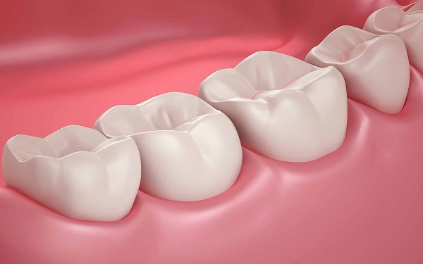 ایمپلنت و جراحی لثه