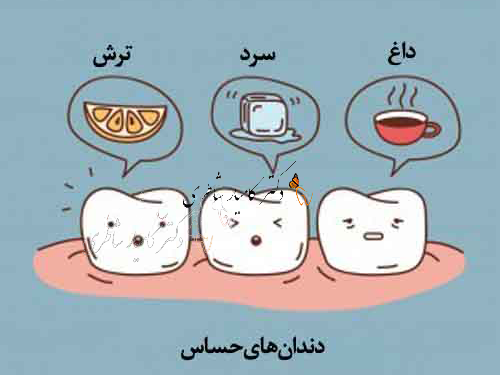 حساسيت عاج دندان