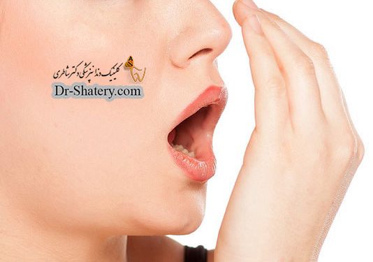 بوی بد دهان ، علل و درمان