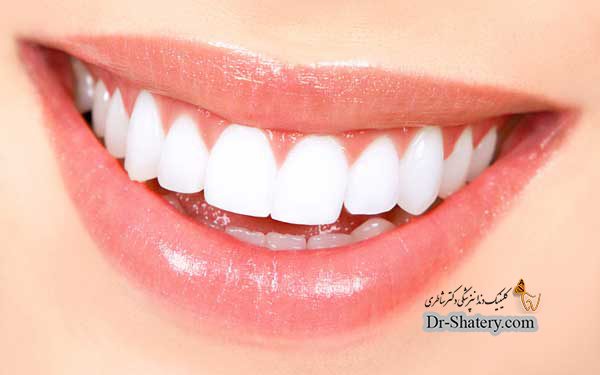 داشتن لبخندی زیبا