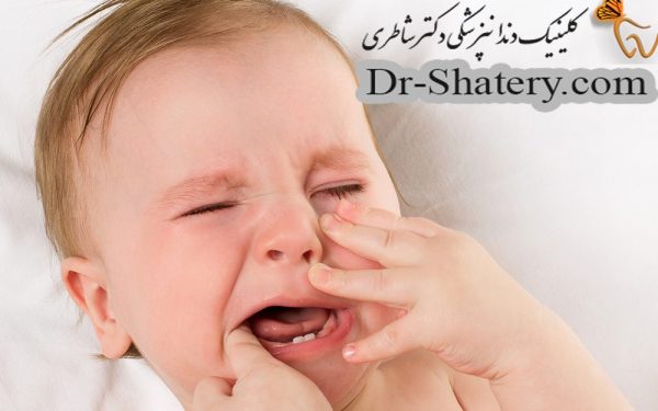 روش های کاهش درد دندان در اوردن نوزادان