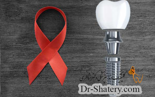 ایمپلنت و ایدز