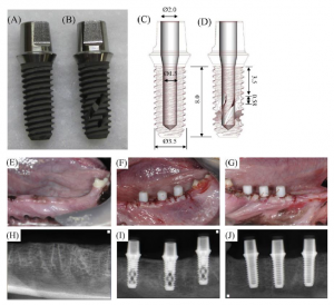 تصویر بازسازی و رشد استخوان به داخل دهانه های جانبی و کانال تو خالی ایمپلنت¬ دندانی
